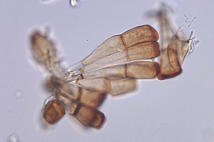 Roggenbraunrost (Puccinia recondita secalis) Teleutosporen