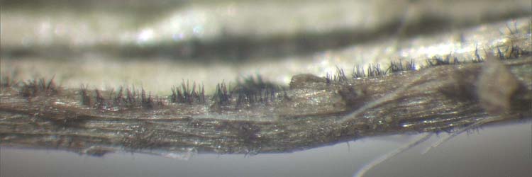 Südlicher Stängelbrenner (Colletotrichum trifolii): Setae