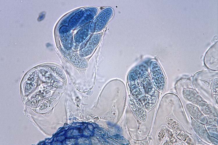 Blattbrand (Leptosphaerulina trifolii) an Weissklee: Asci mit Ascosporen