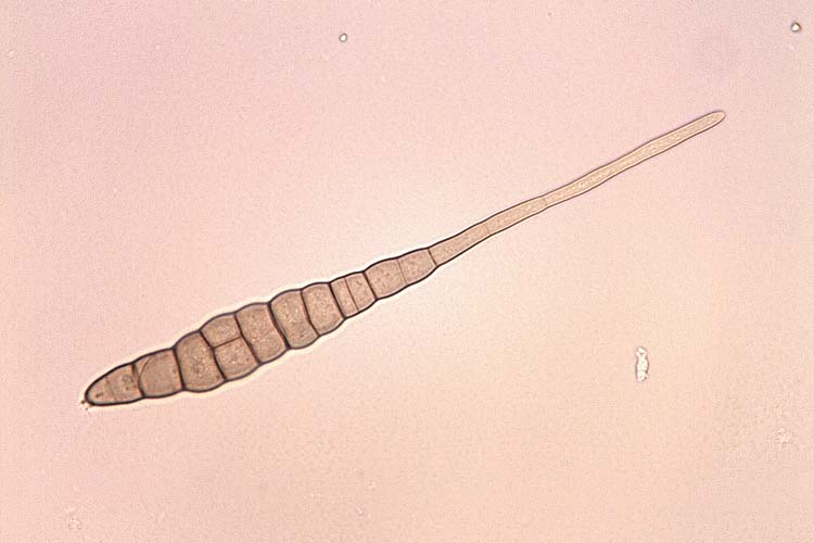 Alternaria brassicae Kohlschwaerze Raps Mik 10 2k