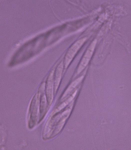 Gibberella zeae: Asci mit Ascosporen