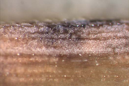 Ramularia collo-cygni