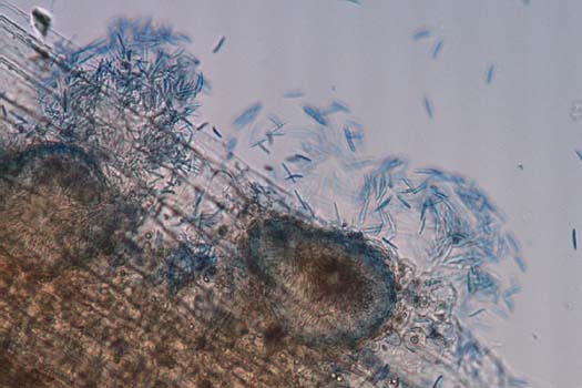 Blatt- und Spelzenbräune des Weizens (Septoria nodorum): Pyknidien mit Pyknosporen