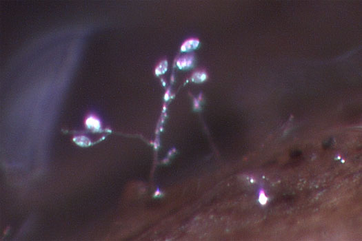 Sporangieträger mit Sporangien von Phytophthora infestans