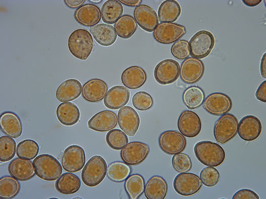 Uredosporen der Uromyces betae