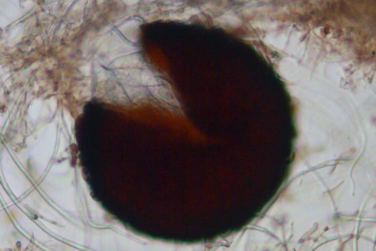 Echter Mehltau der Gräser (Blumeria graminis): Kleistothecium