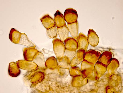 Braunrost (Puccinia loliina): Teleutosporen