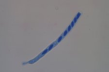 Sonnenblumenkrebs (Sclerotinia sclerotiorum)